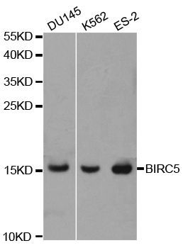 Western blot - BIRC5 Polyclonal Antibody (144-01551)