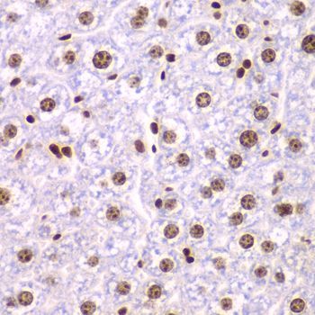 Immunohistochemistry - SSRP1 Polyclonal Antibody (144-06413)
