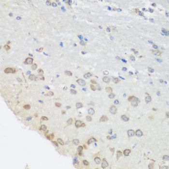 Immunohistochemistry - PUM1 antibody (144-06108)