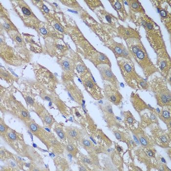 Immunohistochemistry - CAD antibody (144-08344)