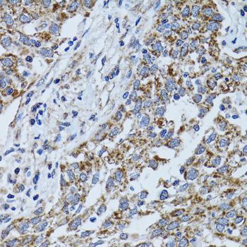Immunohistochemistry - ATP5B Polyclonal Antibody (144-05769)
