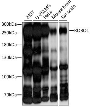 Western blot - ROBO1 antibody (144-015313)