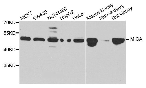 Western blot - MICA antibody (144-01390)