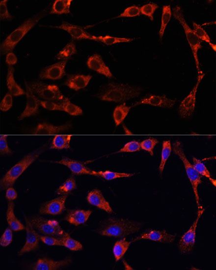 Immunofluorescence - mTOR Polyclonal Antibody (144-02445)