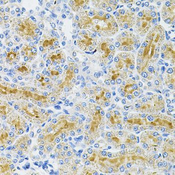 Immunohistochemistry - DDX20 Antibody (144-05817)