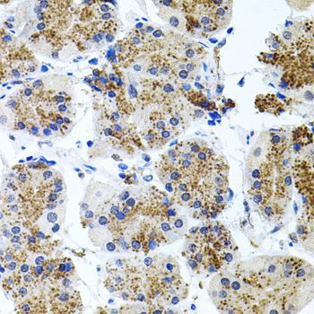 Immunohistochemistry - SSTR2 antibody (144-03135)