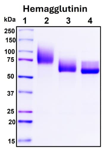 SDS-PAGE Image