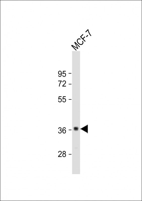 WB