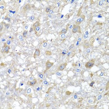 Immunohistochemistry - MTX1 antibody (144-07912)