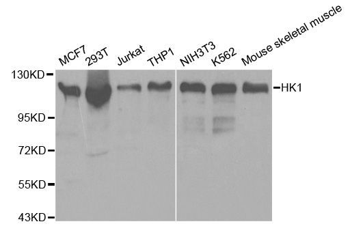 Western blot - HK1 Polyclonal Antibody (144-01054)