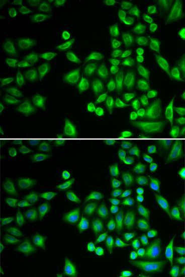 Immunohistochemistry - [KO Validated] PTPN1 Polyclonal Antibody (144-01590)