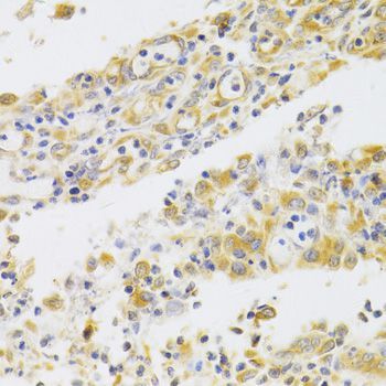 Immunohistochemistry - PA2G4 Antibody (144-05376)