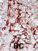 IHC-P