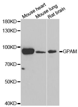 Western blot - GPAM antibody (144-06610)