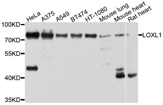 Western blot - LOXL1 Polyclonal Antibody (144-10191)