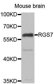 Western blot - RGS7 antibody (144-06720)