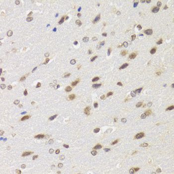 Western blot - [KO Validated] BAZ1B Polyclonal Antibody (144-09851)