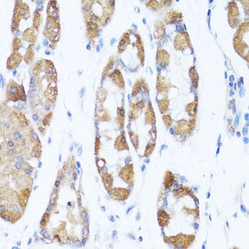 Immunohistochemistry - ATG5 Polyclonal Antibody (144-00203)