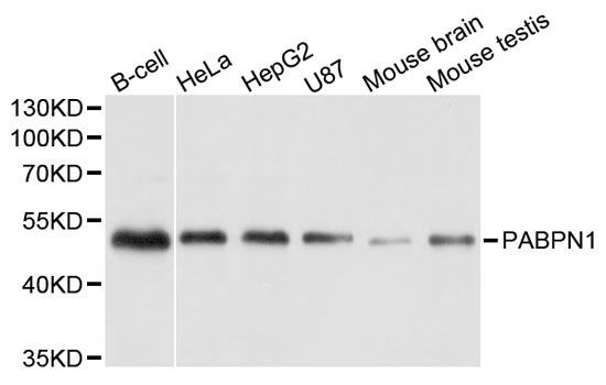 Western blot - PABPN1 antibody (144-06041)