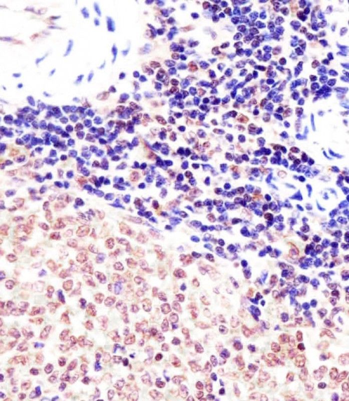 IHC-P