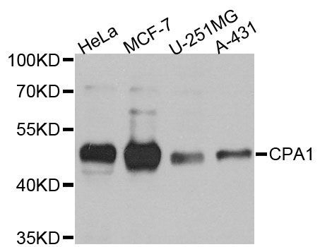 Western blot - CPA1 antibody (144-03803)