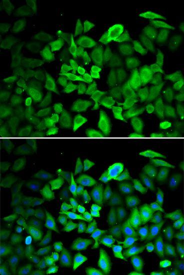 Immunohistochemistry - [KO Validated] ANXA1 Polyclonal Antibody (144-01118)