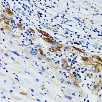 Immunohistochemistry - USO1 Polyclonal Antibody (144-02796)