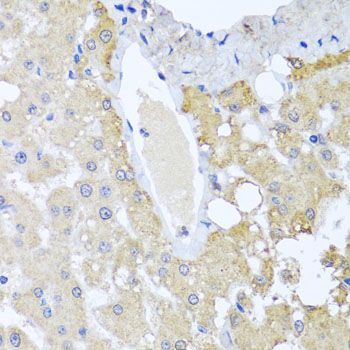 Immunohistochemistry - SULT1A1 antibody (144-01599)