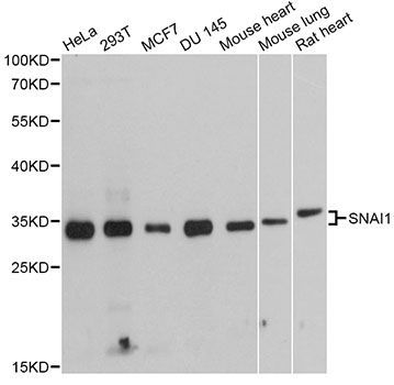 Western blot - SNAI1 antibody (144-011794)