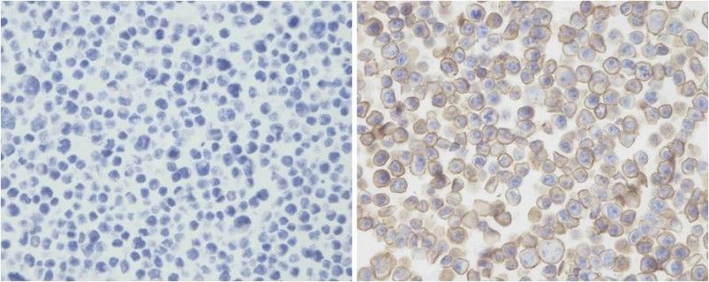 IHC-P