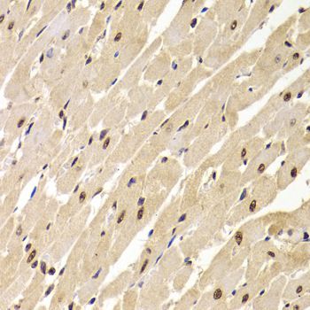 Immunohistochemistry - SNRPA Antibody (144-06410)