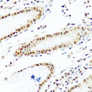 Immunohistochemistry - PRPF19 Polyclonal Antibody (144-12590)