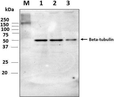 Western blot image