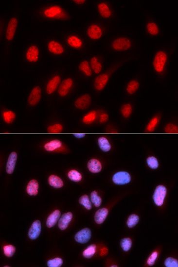 Immunofluorescence - RFC4 Polyclonal Antibody (144-05485)