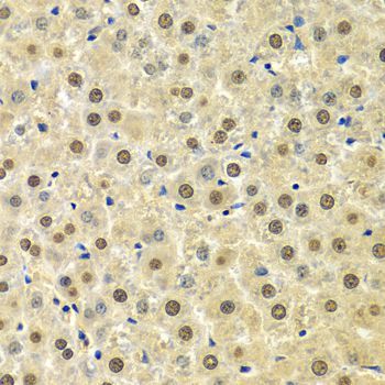 Immunohistochemistry - SPHK1 Polyclonal Antibody (144-00139)