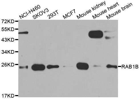 Western blot - RAB1B antibody (144-07514)