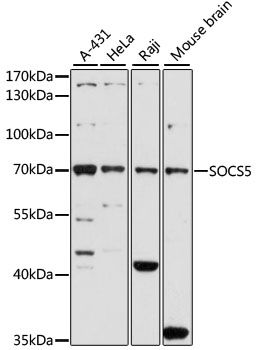 Western blot - SOCS5 antibody (144-61454)