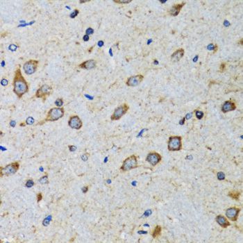 Immunohistochemistry - CDK1 Polyclonal Antibody (144-00220)