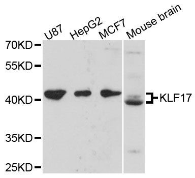 Western blot - KLF17 antibody (144-60468)