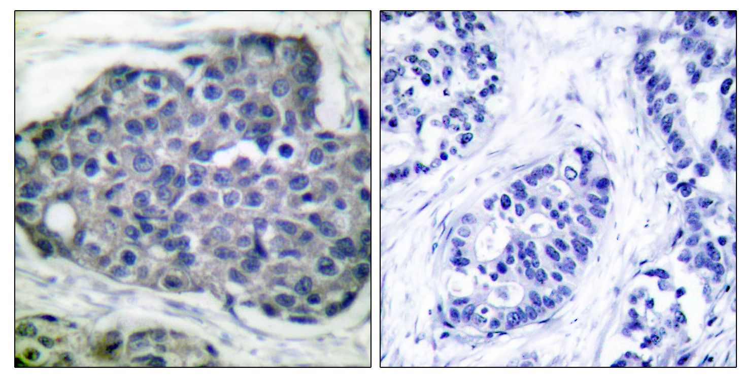 IHC