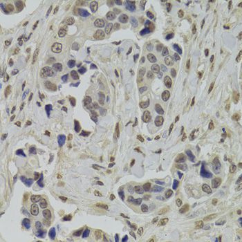 Immunohistochemistry - INTS6 Antibody (144-06634)