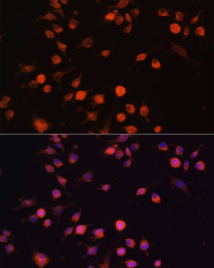 Immunofluorescence - PTK2 Polyclonal Antibody (144-60065)