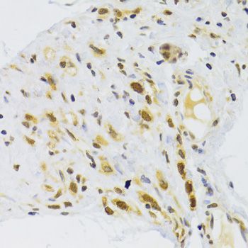 Immunohistochemistry - RPL13 Polyclonal Antibody (144-06723)