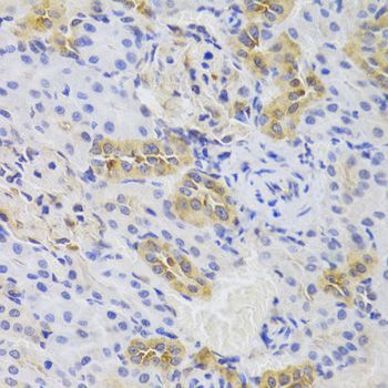 Immunohistochemistry - TSC22D3 Polyclonal Antibody (144-06779)