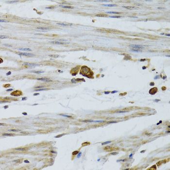 Immunohistochemistry - KRT5 Antibody (144-02662)