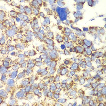 Immunohistochemistry - GLUD2 antibody (144-06604)