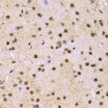 Immunohistochemistry - SNRPE Antibody (144-05488)