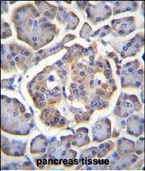 IHC-P