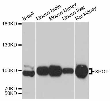 Western blot - XPOT antibody (144-12043)
