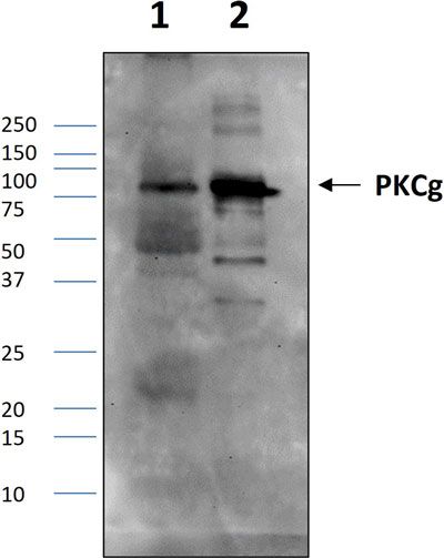 Western blot